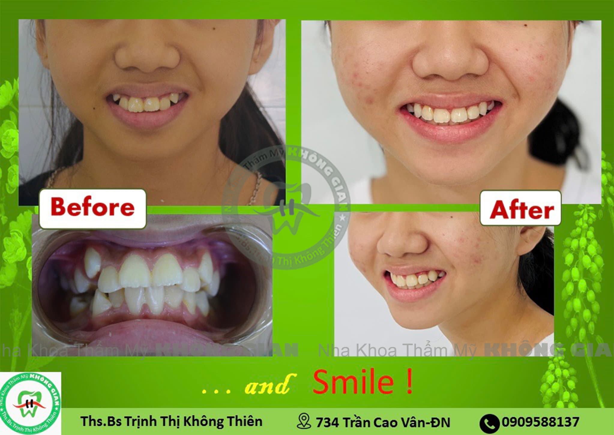 ☘️GIẢI MÃ NỤ CƯỜI☘️